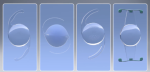 4 different intraocular lenses on a blue background
