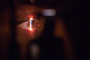 What are the most advanced technologies for LASIK?; close up of an eye, low light, with a line of light on the eye. There is an out of focus device between viewer and the eye